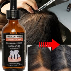 Hair regrowth serum with biotin regrowth treatment for scalp and hair loss