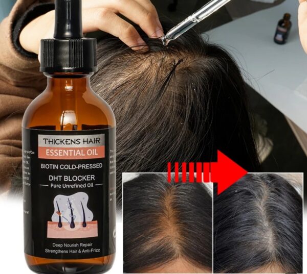 Hair regrowth serum with biotin regrowth treatment for scalp and hair loss