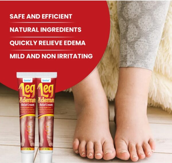 Edema body care cream