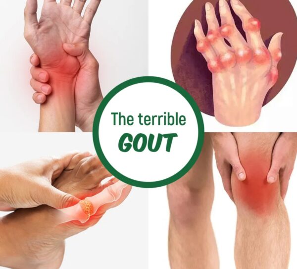 Gout uric tea is 100% natural herbal, help and ease joint discomfort - Image 2